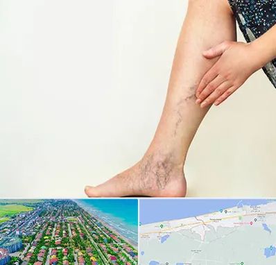 دکتر واریس در فریدونکنار