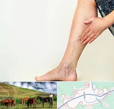 دکتر واریس در تالش