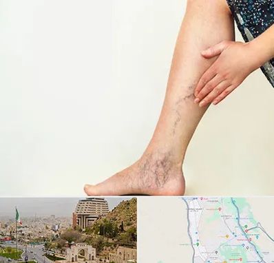 دکتر واریس در فرهنگ شهر شیراز 