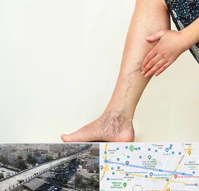 دکتر واریس در فرجام 