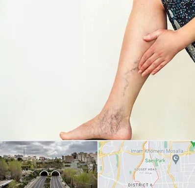 دکتر واریس در یوسف آباد 