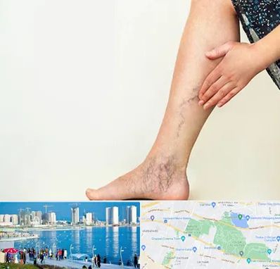 دکتر واریس در چیتگر 