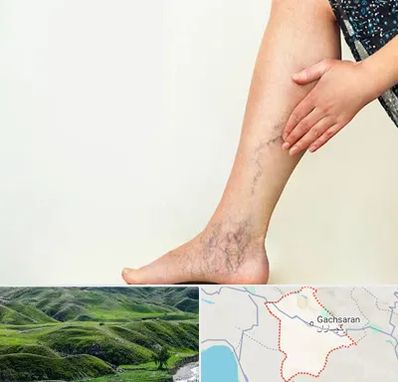 دکتر واریس در گچساران