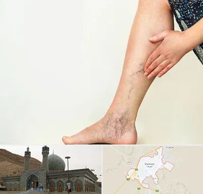 دکتر واریس در شهرضا