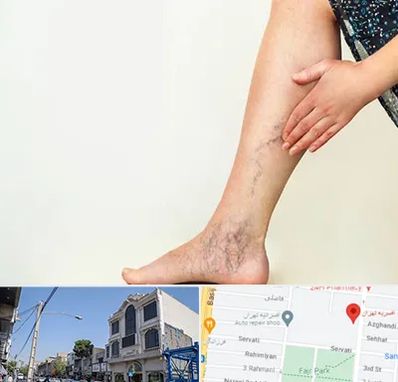 دکتر واریس در افسریه 