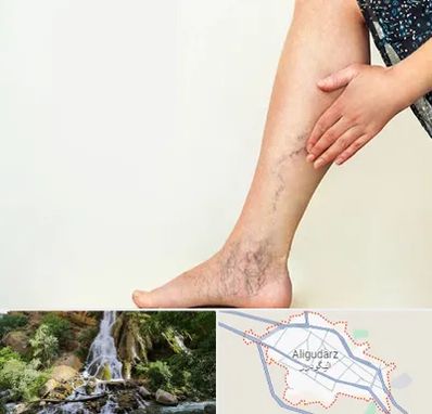 دکتر واریس در الیگودرز