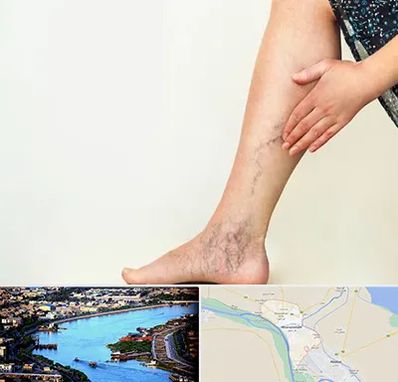 دکتر واریس در خرمشهر