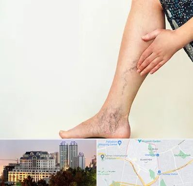 دکتر واریس در فرشته 