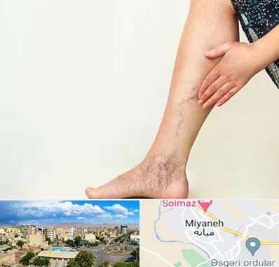 دکتر واریس در میانه