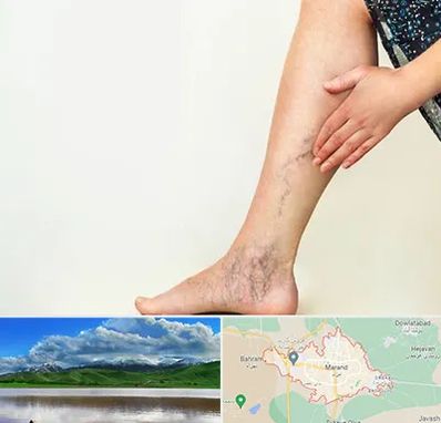 دکتر واریس در مرند