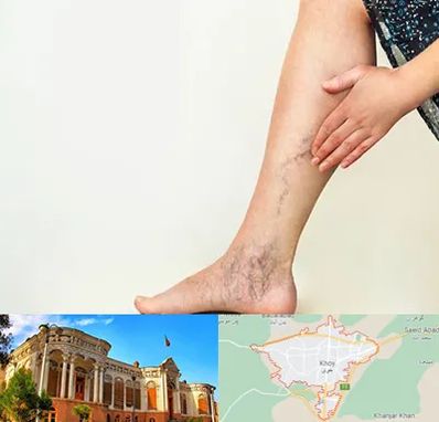 دکتر واریس در خوی