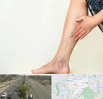 دکتر واریس در منطقه 17 تهران 