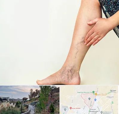 دکتر واریس در باغستان کرج 