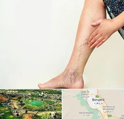 دکتر واریس در بروجرد