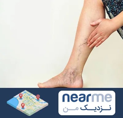 دکتر واریس در نزدیک من