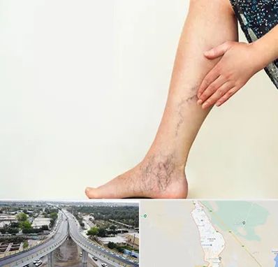 دکتر واریس در اندیمشک