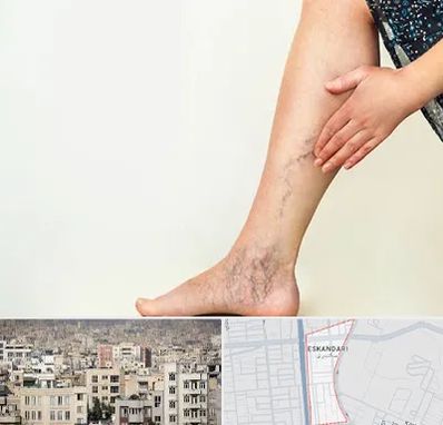 دکتر واریس در اسکندری