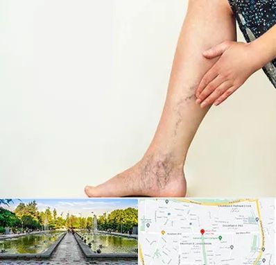 دکتر واریس در سرسبز 