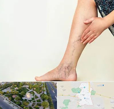 دکتر واریس در کاشمر