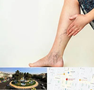 دکتر واریس در هفت حوض 