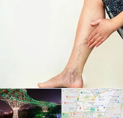 دکتر واریس در منطقه 3 تهران 