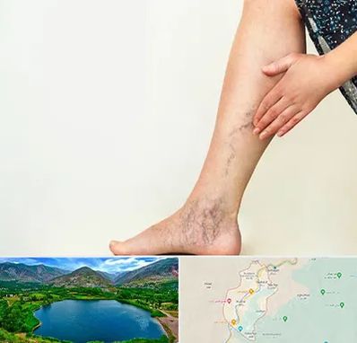 دکتر واریس در رودبار