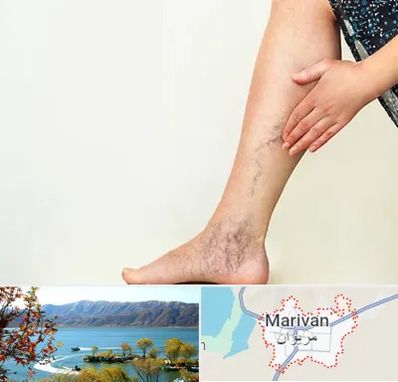 دکتر واریس در مریوان