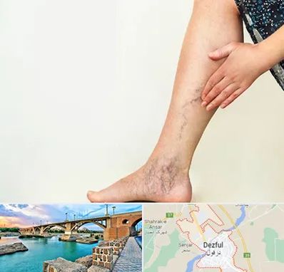 دکتر واریس در دزفول