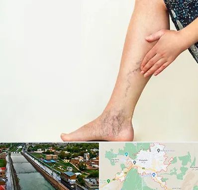 دکتر واریس در مراغه