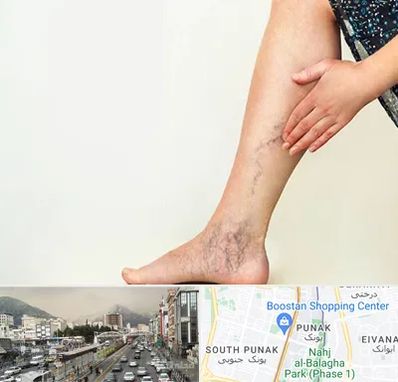 دکتر واریس در پونک 