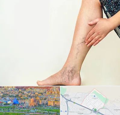 دکتر واریس در رشدیه تبریز