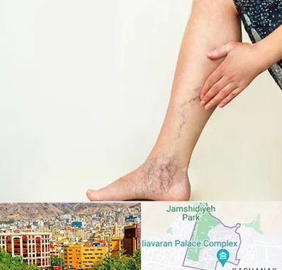 دکتر واریس در نیاوران 