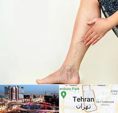 دکتر واریس در صادقیه 