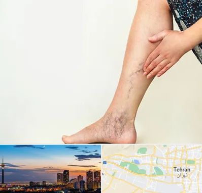 دکتر واریس در غرب تهران 