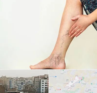 دکتر واریس در محمد شهر کرج 