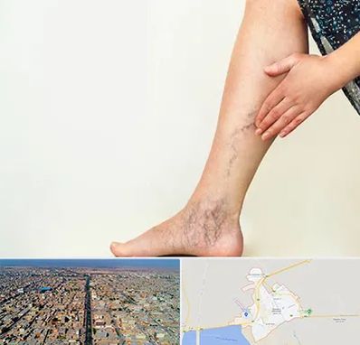 دکتر واریس در بندر ماهشهر