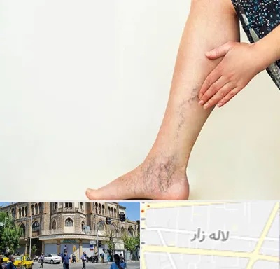 دکتر واریس در لاله زار