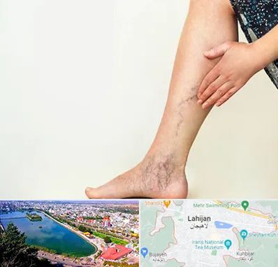 دکتر واریس در لاهیجان