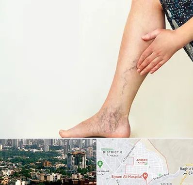 دکتر واریس در عظیمیه کرج 