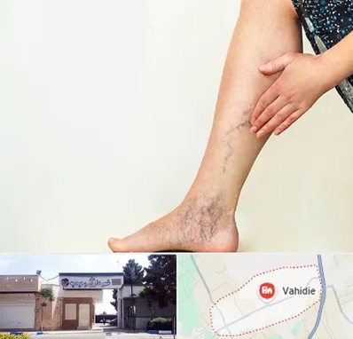 دکتر واریس در وحیدیه شهریار