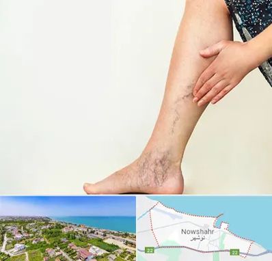 دکتر واریس در نوشهر