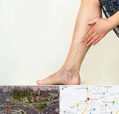 دکتر واریس در سبلان 