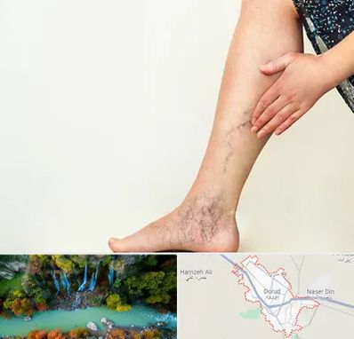 دکتر واریس در دورود