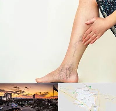 دکتر واریس در قوچان