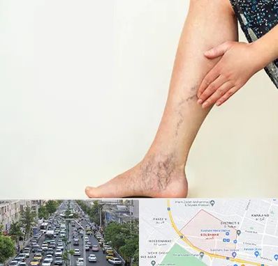 دکتر واریس در گلشهر کرج 