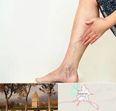 دکتر واریس در تویسرکان