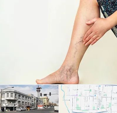 دکتر واریس در 17شهریور