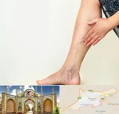 دکتر واریس در سمنان