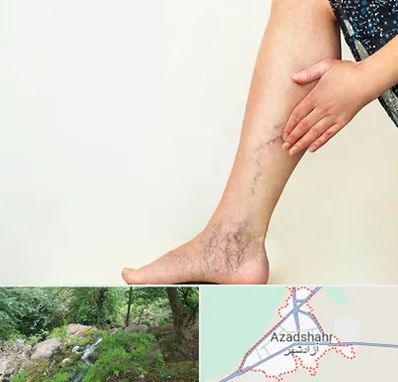 دکتر واریس در آزادشهر