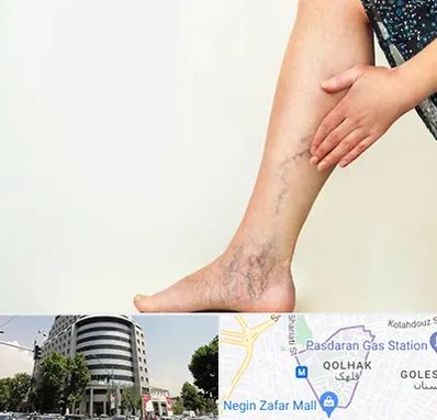 دکتر واریس در قلهک 